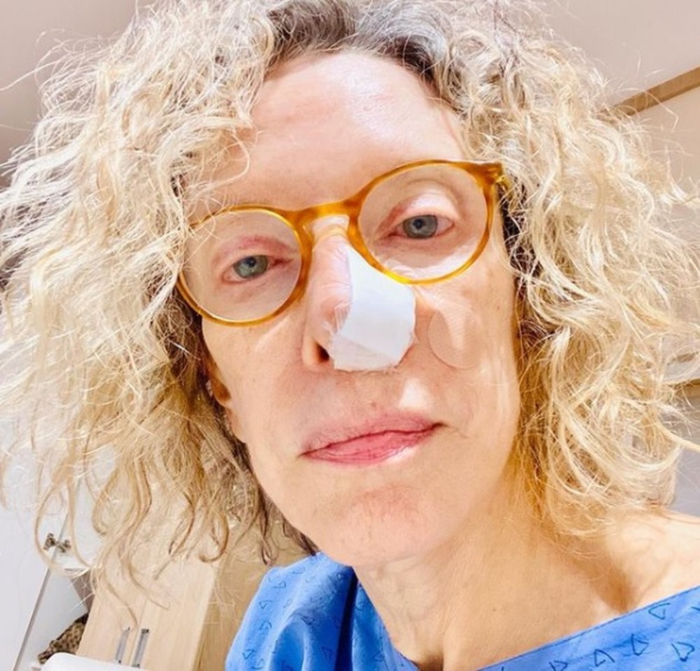 Marília Gabriela passa por cirurgia para retirar câncer no nariz